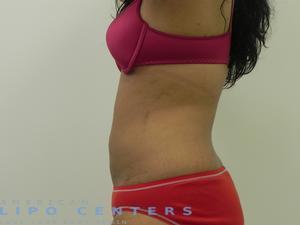 americanlipocenters_66.jpg
